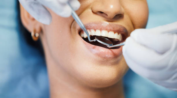 Best Emergency Root Canal Therapy in Marshallville, GA